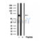 Western blot analysis of extracts from various samples, using MKS1 Antibody.
 Lane 1: HUVEC treated with blocking peptide;
 Lane 2: HUVEC;
 Lane 3: VERO.