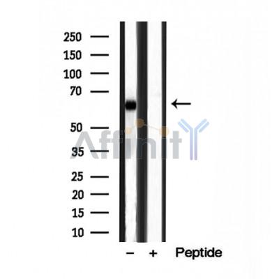Western blot analysis of extracts from various samples, using MKS1 Antibody.
 Lane 1: HUVEC treated with blocking peptide;
 Lane 2: HUVEC;
 Lane 3: VERO.