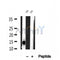 DF12028 at 1/100 staining Human lung tissue by IHC-P. The sample was formaldehyde fixed and a heat mediated antigen retrieval step in citrate buffer was performed. The sample was then blocked and incubated with the antibody for 1.5 hours at 22¡ãC. An HRP conjugated goat anti-rabbit antibody was used as the secondary