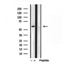 Western blot analysis of extracts from Sp2/0, using TCTN1 Antibody. Lane 1 was treated with the blocking peptide.