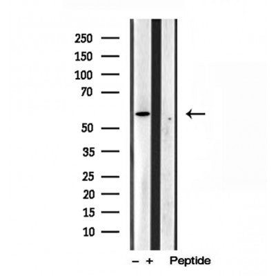 Western blot analysis of extracts from Sp2/0, using TCTN1 Antibody. Lane 1 was treated with the blocking peptide.