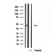 Western blot analysis of extracts from Rat heart, using BBS5 Antibody. Lane 1 was treated with the blocking peptide.