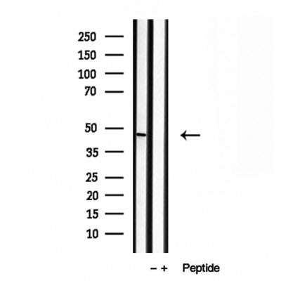 Western blot analysis of extracts from Rat heart, using BBS5 Antibody. Lane 1 was treated with the blocking peptide.