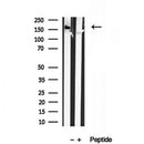DF12031 staining HepG2 by IF/ICC. The sample were fixed with PFA and permeabilized in 0.1% Triton X-100,then blocked in 10% serum for 45 minutes at 25¡ãC. The primary antibody was diluted at 1/200 and incubated with the sample for 1 hour at 37¡ãC. An  Alexa Fluor 594 conjugated goat anti-rabbit IgG (H+L) Ab, diluted at 1/600, was used as the secondary antibod