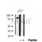 DF12032 at 1/100 staining Human brain cancer tissue by IHC-P. The sample was formaldehyde fixed and a heat mediated antigen retrieval step in citrate buffer was performed. The sample was then blocked and incubated with the antibody for 1.5 hours at 22¡ãC. An HRP conjugated goat anti-rabbit antibody was used as the secondary