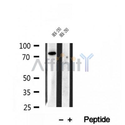 DF12032 at 1/100 staining Human brain cancer tissue by IHC-P. The sample was formaldehyde fixed and a heat mediated antigen retrieval step in citrate buffer was performed. The sample was then blocked and incubated with the antibody for 1.5 hours at 22¡ãC. An HRP conjugated goat anti-rabbit antibody was used as the secondary
