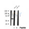 DF12033 at 1/100 staining Mouse kidney tissue by IHC-P. The sample was formaldehyde fixed and a heat mediated antigen retrieval step in citrate buffer was performed. The sample was then blocked and incubated with the antibody for 1.5 hours at 22¡ãC. An HRP conjugated goat anti-rabbit antibody was used as the secondary