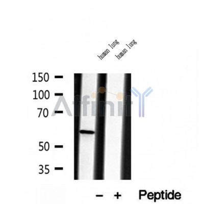 DF12033 at 1/100 staining Mouse kidney tissue by IHC-P. The sample was formaldehyde fixed and a heat mediated antigen retrieval step in citrate buffer was performed. The sample was then blocked and incubated with the antibody for 1.5 hours at 22¡ãC. An HRP conjugated goat anti-rabbit antibody was used as the secondary