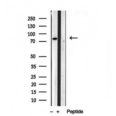 DF12034 at 1/100 staining Mouse kidney tissue by IHC-P. The sample was formaldehyde fixed and a heat mediated antigen retrieval step in citrate buffer was performed. The sample was then blocked and incubated with the antibody for 1.5 hours at 22¡ãC. An HRP conjugated goat anti-rabbit antibody was used as the secondary