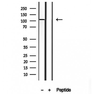 Western blot analysis of extracts from 293, using MKS3 antibody. Lane 1 was treated with the blocking peptide.