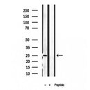 Western blot analysis of extracts from various samples, using PLDN antibody.
 Lane 1: HepG2 treated with blocking peptide.
 Lane 2: HepG2;
 Lane 3: 293;
 
