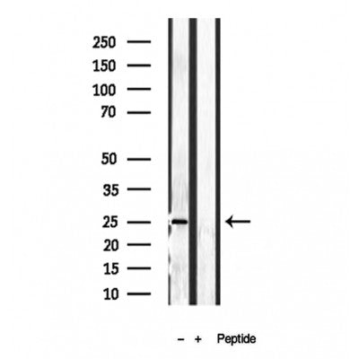 Western blot analysis of extracts from various samples, using PLDN antibody.
 Lane 1: HepG2 treated with blocking peptide.
 Lane 2: HepG2;
 Lane 3: 293;
 