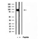 DF12043 staining HepG2 by IF/ICC. The sample were fixed with PFA and permeabilized in 0.1% Triton X-100,then blocked in 10% serum for 45 minutes at 25¡ãC. The primary antibody was diluted at 1/200 and incubated with the sample for 1 hour at 37¡ãC. An  Alexa Fluor 594 conjugated goat anti-rabbit IgG (H+L) Ab, diluted at 1/600, was used as the secondary antibod