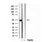 DF12044 staining HepG2 by IF/ICC. The sample were fixed with PFA and permeabilized in 0.1% Triton X-100,then blocked in 10% serum for 45 minutes at 25¡ãC. The primary antibody was diluted at 1/200 and incubated with the sample for 1 hour at 37¡ãC. An  Alexa Fluor 594 conjugated goat anti-rabbit IgG (H+L) Ab, diluted at 1/600, was used as the secondary antibod