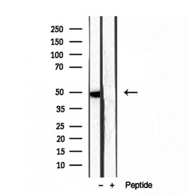 DF12044 staining HepG2 by IF/ICC. The sample were fixed with PFA and permeabilized in 0.1% Triton X-100,then blocked in 10% serum for 45 minutes at 25¡ãC. The primary antibody was diluted at 1/200 and incubated with the sample for 1 hour at 37¡ãC. An  Alexa Fluor 594 conjugated goat anti-rabbit IgG (H+L) Ab, diluted at 1/600, was used as the secondary antibod