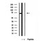 Western blot analysis of extracts from various samples, using TOM70 antibody.
 Lane 1: HepG2 treated with blocking peptide.
 Lane 2: HepG2;
 Lane 3: 293;
 