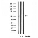 Western blot analysis of extracts from mouse brain, using ACOX1 antibody. Lane 1 was treated with the blocking peptide.