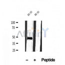 DF12047 at 1/100 staining Human lymph tissue by IHC-P. The sample was formaldehyde fixed and a heat mediated antigen retrieval step in citrate buffer was performed. The sample was then blocked and incubated with the antibody for 1.5 hours at 22¡ãC. An HRP conjugated goat anti-rabbit antibody was used as the secondary