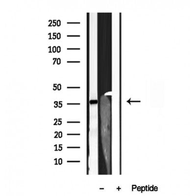 DF12048 at 1/100 staining Mouse liver tissue by IHC-P. The sample was formaldehyde fixed and a heat mediated antigen retrieval step in citrate buffer was performed. The sample was then blocked and incubated with the antibody for 1.5 hours at 22¡ãC. An HRP conjugated goat anti-rabbit antibody was used as the secondary