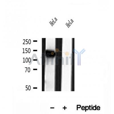 DF12049 at 1/100 staining Mouse kidney tissue by IHC-P. The sample was formaldehyde fixed and a heat mediated antigen retrieval step in citrate buffer was performed. The sample was then blocked and incubated with the antibody for 1.5 hours at 22¡ãC. An HRP conjugated goat anti-rabbit antibody was used as the secondary