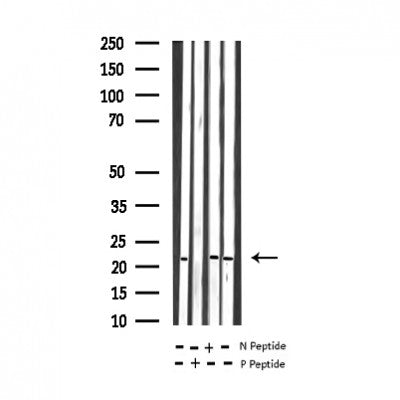 Western blot analysis of Phospho-RhoA (Ser188) expression in various lysates