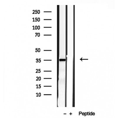 DF12051 staining HepG2 by IF/ICC. The sample were fixed with PFA and permeabilized in 0.1% Triton X-100,then blocked in 10% serum for 45 minutes at 25¡ãC. The primary antibody was diluted at 1/200 and incubated with the sample for 1 hour at 37¡ãC. An  Alexa Fluor 594 conjugated goat anti-rabbit IgG (H+L) Ab, diluted at 1/600, was used as the secondary antibod