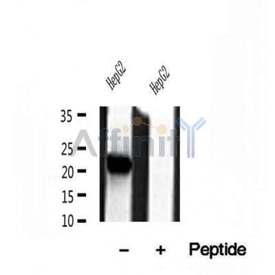 DF12052 at 1/100 staining Mouse kidney tissue by IHC-P. The sample was formaldehyde fixed and a heat mediated antigen retrieval step in citrate buffer was performed. The sample was then blocked and incubated with the antibody for 1.5 hours at 22¡ãC. An HRP conjugated goat anti-rabbit antibody was used as the secondary