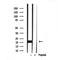 Western blot analysis of extracts from rat brain, using Transgelin 2 antibody. Lane 1 was treated with the blocking peptide.