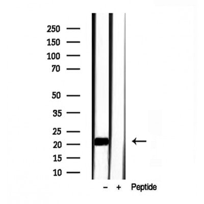Western blot analysis of extracts from rat brain, using Transgelin 2 antibody. Lane 1 was treated with the blocking peptide.