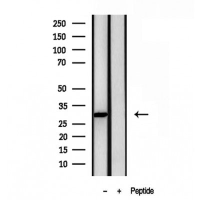 Western blot analysis of extracts from mouse lung, using Galc antibody. Lane 1 was treated with the blocking peptide.