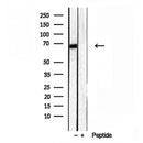 Western blot analysis of extracts from Rat lung, using LMOD3 Antibody. Lane 1 was treated with the blocking peptide.