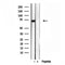 Western blot analysis of extracts from Rat lung, using LMOD3 Antibody. Lane 1 was treated with the blocking peptide.