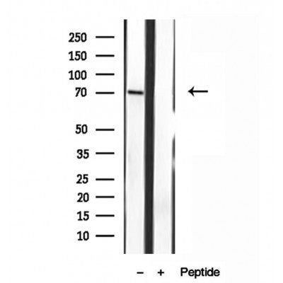 Western blot analysis of extracts from Mouse Myeloma cell, using MPP5 antibody. Lane 1 was treated with the blocking peptide.