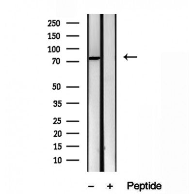 Western blot analysis of extracts from HepG2, using ODF2 antibody. Lane 1 was treated with the blocking peptide.