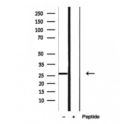 Western blot analysis of extracts from various samples, using RAB27B Antibody.
 Lane 1: 3T3 treated with blocking peptide;
 Lane 2: 3T3;
Lane 3: COS-7.