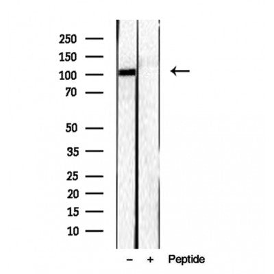 Western blot analysis of extracts from 293, using RBM15 antibody. Lane 1 was treated with the blocking peptide.