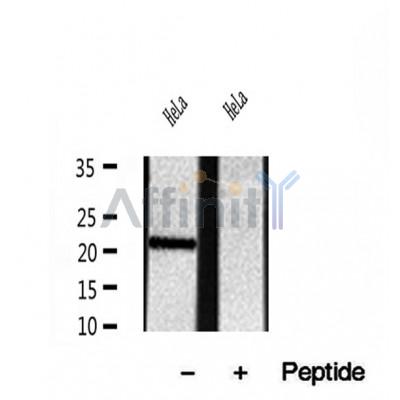 DF12062 at 1/100 staining Mouse testis tissue by IHC-P. The sample was formaldehyde fixed and a heat mediated antigen retrieval step in citrate buffer was performed. The sample was then blocked and incubated with the antibody for 1.5 hours at 22¡ãC. An HRP conjugated goat anti-rabbit antibody was used as the secondary