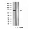 Western blot analysis of extracts from rat muscle, using SQLE antibody. Lane 1 was treated with the blocking peptide.