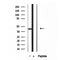 DF12065 at 1/100 staining Human brain cancer tissue by IHC-P. The sample was formaldehyde fixed and a heat mediated antigen retrieval step in citrate buffer was performed. The sample was then blocked and incubated with the antibody for 1.5 hours at 22¡ãC. An HRP conjugated goat anti-rabbit antibody was used as the secondary