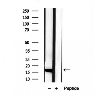 Western blot analysis of extracts from various samples, using CHCHD2 antibody.
 Lane 1: 293 treated with blocking peptide.
 Lane 2: 293;
 Lane 3: mouse brain;
 