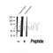 DF12067 at 1/100 staining Human prostate tissue by IHC-P. The sample was formaldehyde fixed and a heat mediated antigen retrieval step in citrate buffer was performed. The sample was then blocked and incubated with the antibody for 1.5 hours at 22¡ãC. An HRP conjugated goat anti-rabbit antibody was used as the secondary