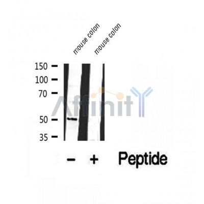 DF12067 at 1/100 staining Human prostate tissue by IHC-P. The sample was formaldehyde fixed and a heat mediated antigen retrieval step in citrate buffer was performed. The sample was then blocked and incubated with the antibody for 1.5 hours at 22¡ãC. An HRP conjugated goat anti-rabbit antibody was used as the secondary