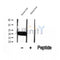 DF12068 at 1/100 staining Mouse lung tissue by IHC-P. The sample was formaldehyde fixed and a heat mediated antigen retrieval step in citrate buffer was performed. The sample was then blocked and incubated with the antibody for 1.5 hours at 22¡ãC. An HRP conjugated goat anti-rabbit antibody was used as the secondary