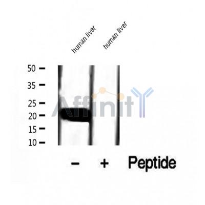 DF12068 at 1/100 staining Mouse lung tissue by IHC-P. The sample was formaldehyde fixed and a heat mediated antigen retrieval step in citrate buffer was performed. The sample was then blocked and incubated with the antibody for 1.5 hours at 22¡ãC. An HRP conjugated goat anti-rabbit antibody was used as the secondary