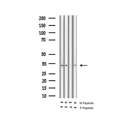 AF3354 staining HeLa by IF/ICC. The sample were fixed with PFA and permeabilized in 0.1% Triton X-100,then blocked in 10% serum for 45 minutes at 25¡ãC. The primary antibody was diluted at 1/200 and incubated with the sample for 1 hour at 37¡ãC. An  Alexa Fluor 594 conjugated goat anti-rabbit IgG (H+L) Ab, diluted at 1/600, was used as the secondary antibod