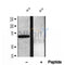 DF12073 at 1/100 staining Mouse kidney tissue by IHC-P. The sample was formaldehyde fixed and a heat mediated antigen retrieval step in citrate buffer was performed. The sample was then blocked and incubated with the antibody for 1.5 hours at 22¡ãC. An HRP conjugated goat anti-rabbit antibody was used as the secondary