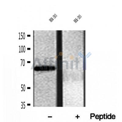 DF12073 at 1/100 staining Mouse kidney tissue by IHC-P. The sample was formaldehyde fixed and a heat mediated antigen retrieval step in citrate buffer was performed. The sample was then blocked and incubated with the antibody for 1.5 hours at 22¡ãC. An HRP conjugated goat anti-rabbit antibody was used as the secondary