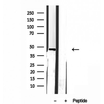 Western blot analysis of extracts from Mouse spleen, using GDI2 Antibody. Lane 1 was treated with the blocking peptide.