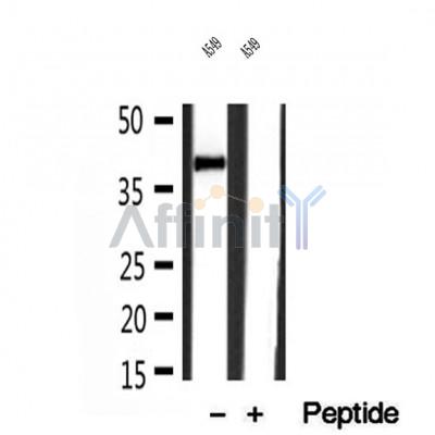 DF12077 at 1/100 staining Mouse spleen tissue by IHC-P. The sample was formaldehyde fixed and a heat mediated antigen retrieval step in citrate buffer was performed. The sample was then blocked and incubated with the antibody for 1.5 hours at 22¡ãC. An HRP conjugated goat anti-rabbit antibody was used as the secondary