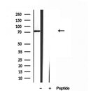 Western blot analysis of extracts from 3T3, using Kindlin 2 Antibody. The lane on the left was treated with blocking peptide.